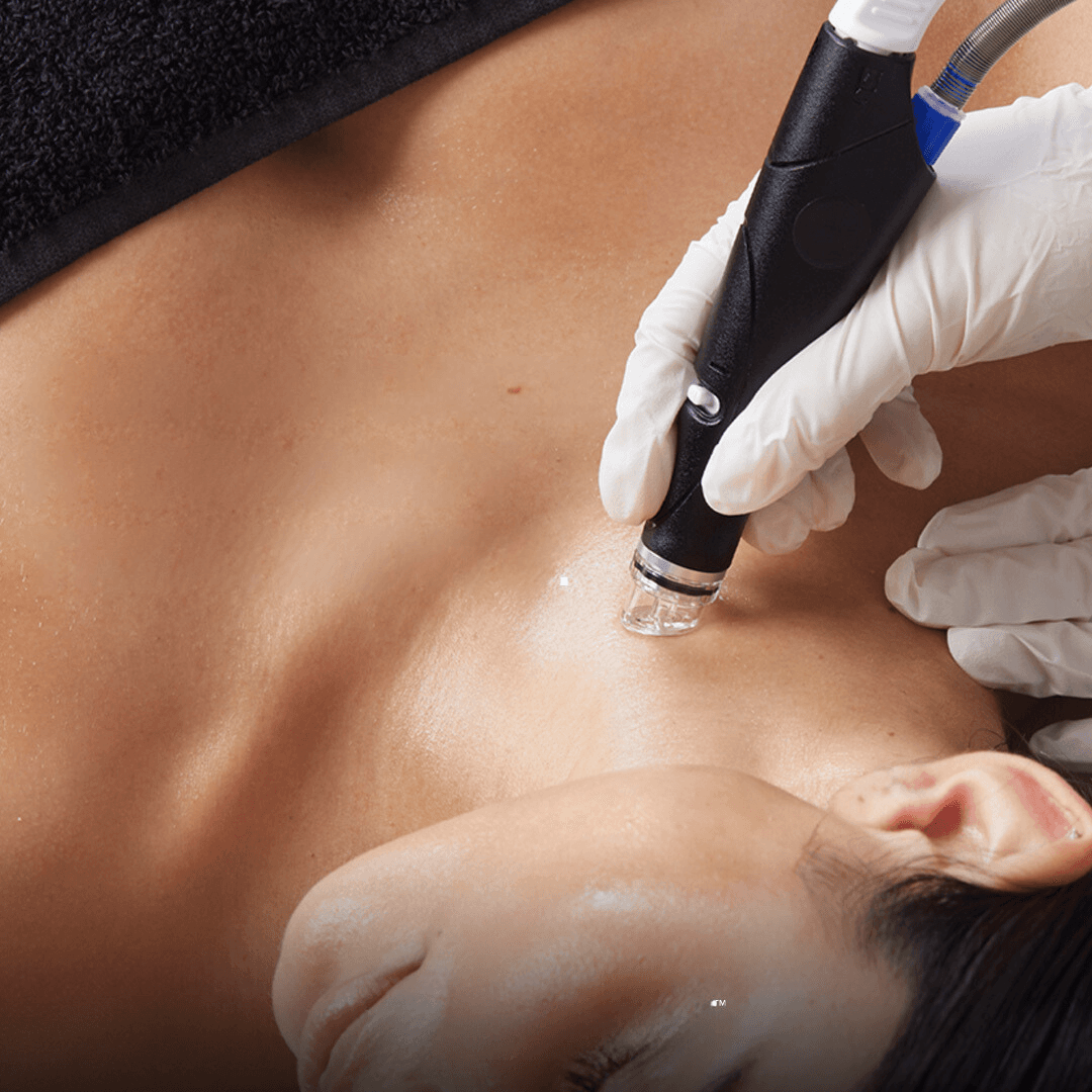 Neck & Décolletage or Hand HydraFacials®