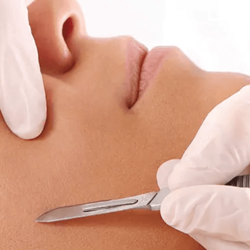 Dermaplaning Facial