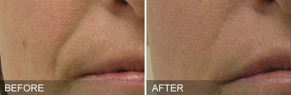 Before and After 1